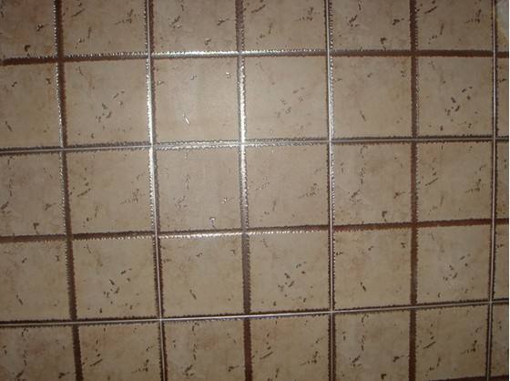 徐汇美缝效果图